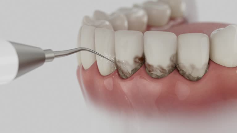 Trusted Invisalign Clear Aligners service in Randleman, NC - Dentist Open Now